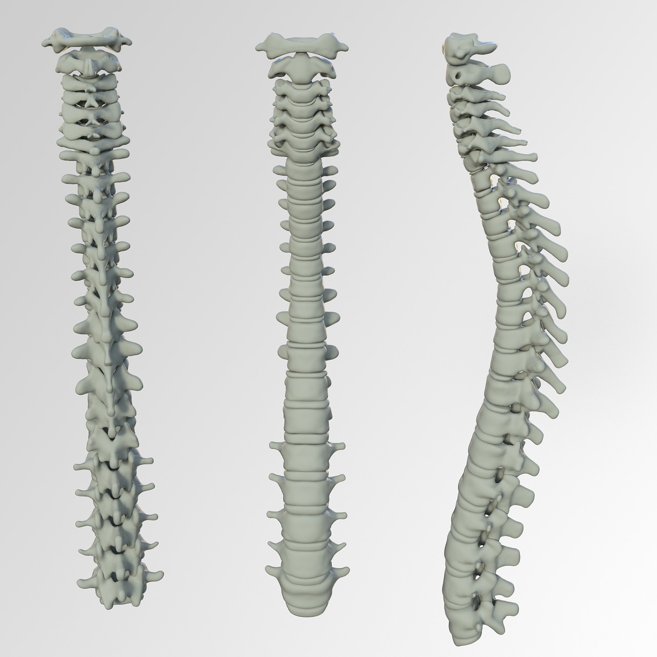 Spinal Screenings Auburn, CA